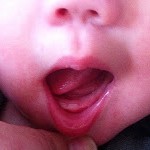 teeth 2
