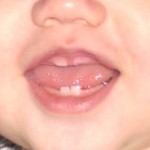 Teeth