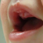 Tooth