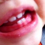 teeth 1